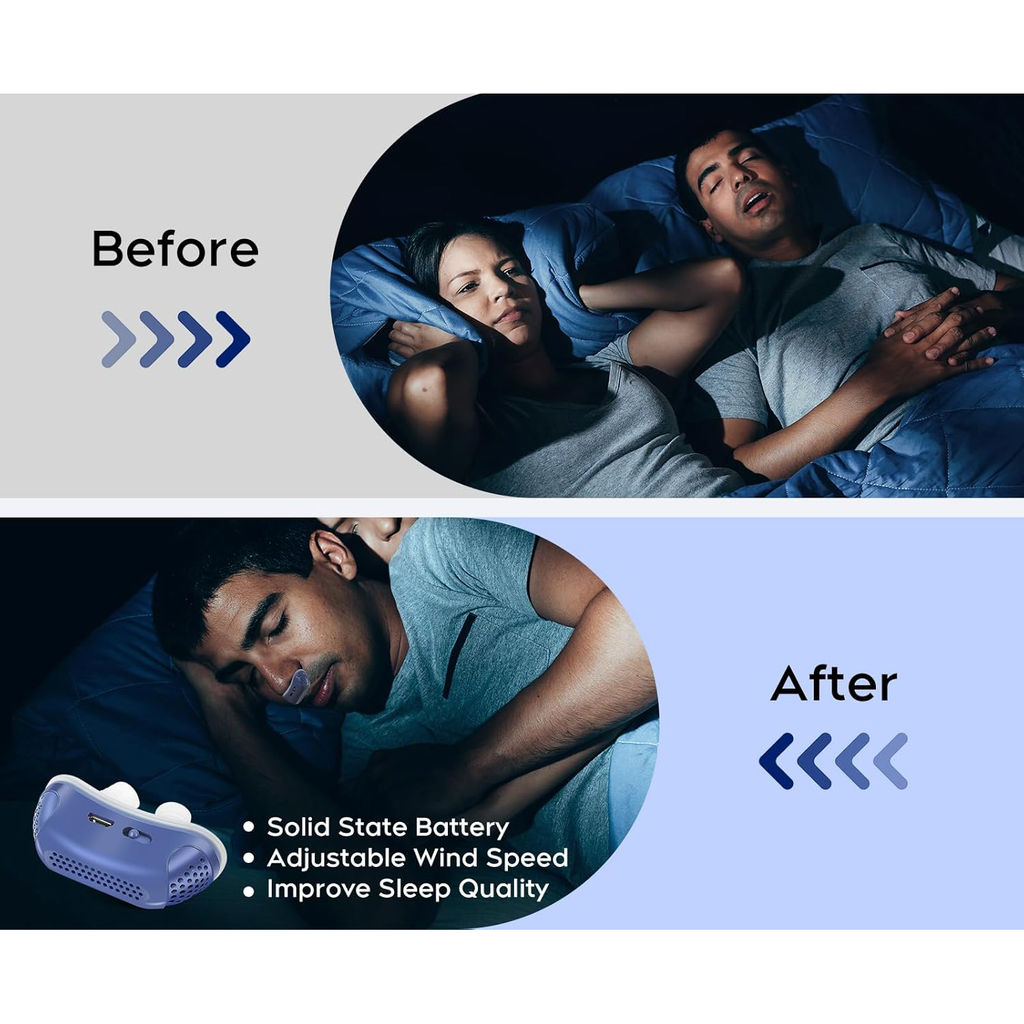 Portable Anti Snoring Device Nasal Travel Rechargeable Silicone USB No Mask - Image 8
